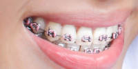 The Best Dental Clinic in India