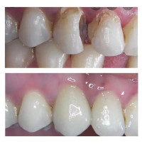 Top Dentist in Delhi - Dr. Ankita Jindal