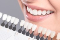 Best dentist in Gurgaon