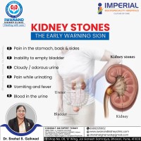 Understanding Kidney Stones: Signs You Shouldn’t Ignore