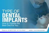Get the Best Dental Implants in Gurgaon at Ministry of Smile