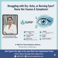 Dry Eyes: Causes, Remedies, and When to Visit a Specialist