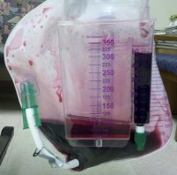 The Impact of Diet and Medications on Chromaturia